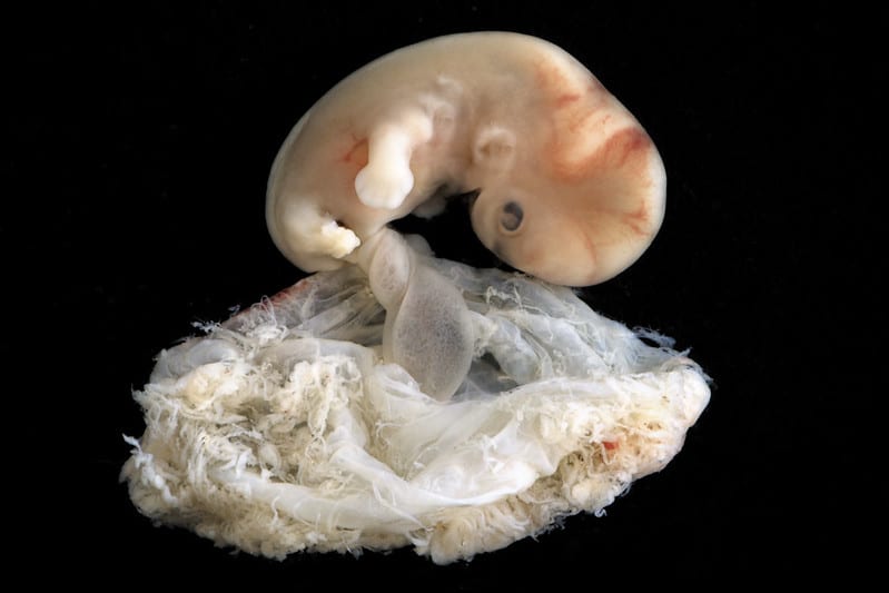 Embrione alla 7° settimana di gravidanza.